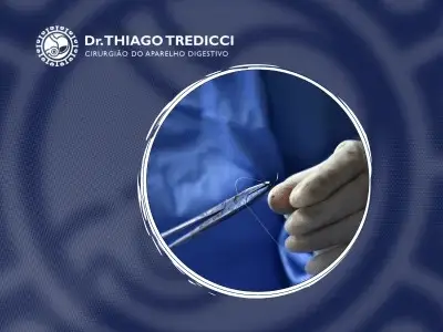 Áreas de atuação do cirurgião geral em Goiânia Dr. Thiago Tredicci