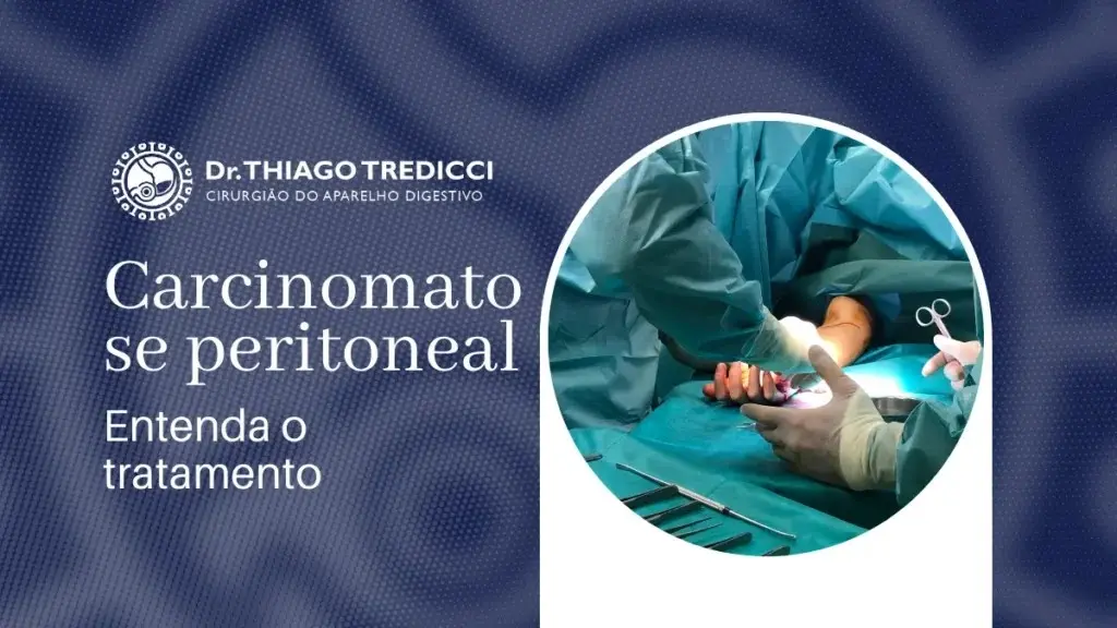 Carcinomatose Peritoneal tem Cura?