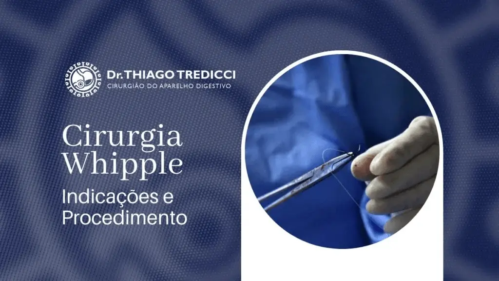 Cirurgia Whipple