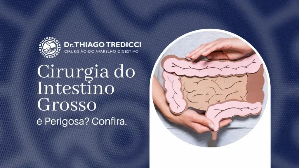 Cirurgia do Intestino Grosso é Perigosa?