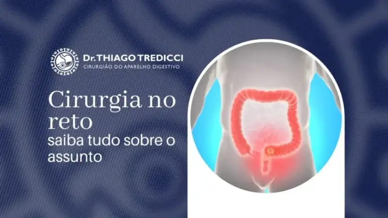 Cirurgia do câncer no reto