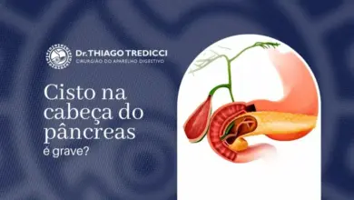Cisto na cabeça do pâncreas é grave?