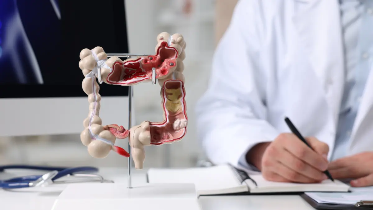 Gastroenterologista Cuida do Intestino? Explorando Tratamentos Específicos