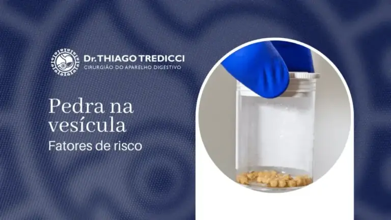 O que causa pedra na vesícula