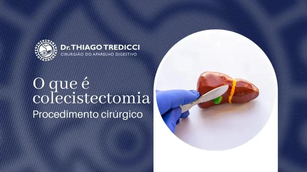 O que é Colecistectomia? Entenda Quando Ela é Indicada