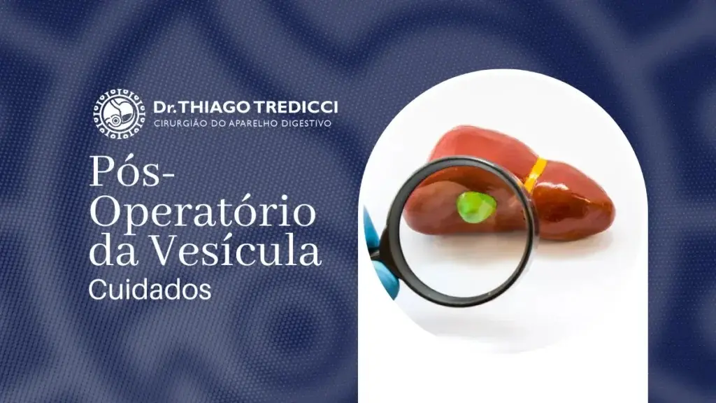 Pós-Operatório da Vesícula