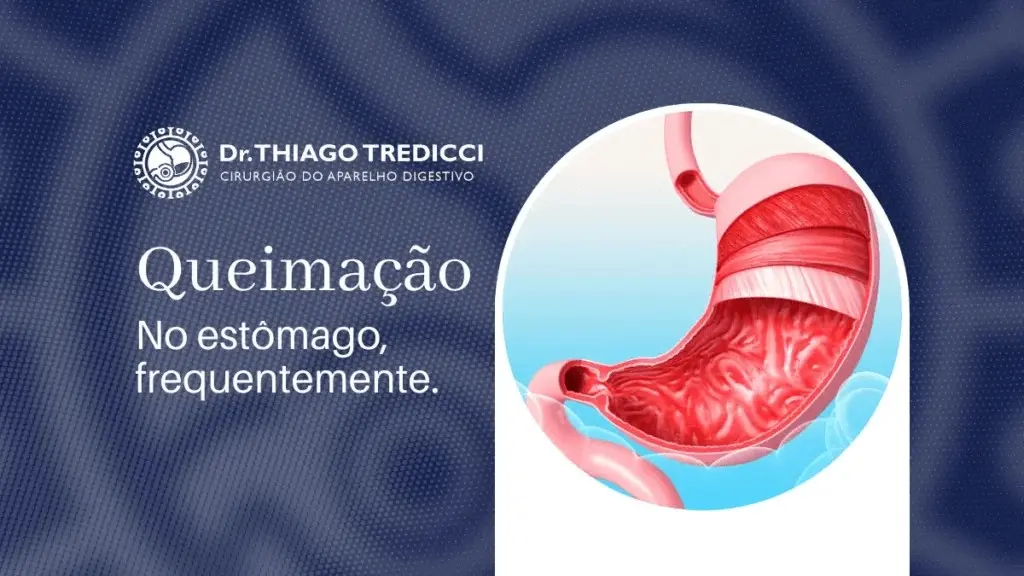 Queimação no estômago