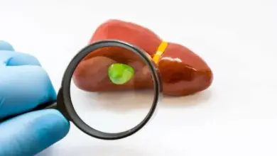Vesícula Inflamada Pode Matar