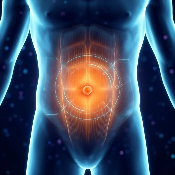 Cirurgia de Hérnia Umbilical em Goiânia