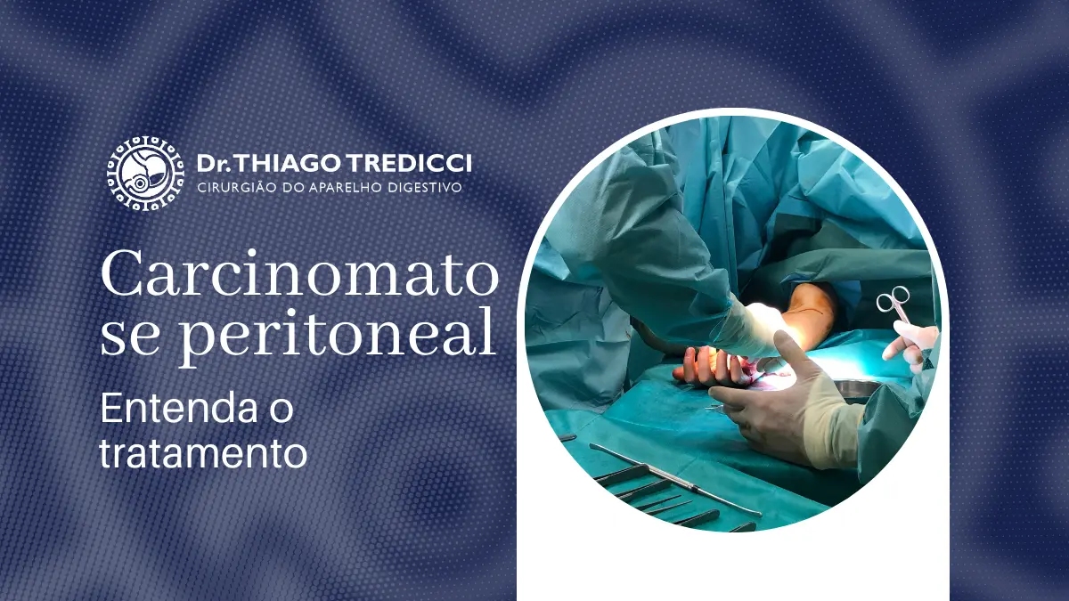 Carcinomatose peritoneal tem cura Entenda o tratamento e prognóstico
