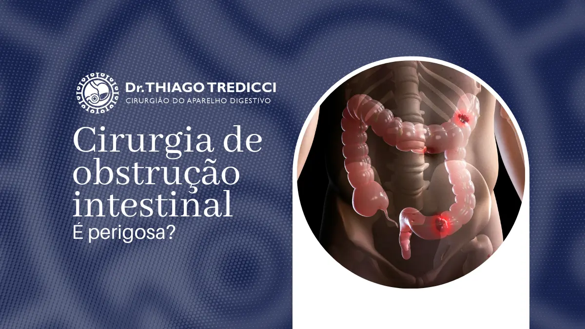 Cirurgia de obstrução intestinal é perigosa Conheça os riscos e precauções