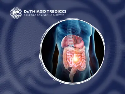Problemas mais frequentes no intestino Descubra os distúrbios intestinais comuns e suas soluções