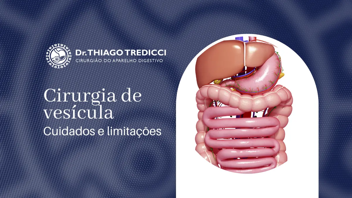 Quem fez cirurgia de vesícula pode se abaixar? Confira aqui!