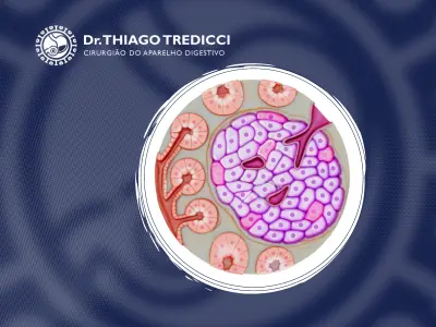 Sintomas, diagnóstico e abordagens terapêuticas para cistos pancreáticos Cisto no pâncreas