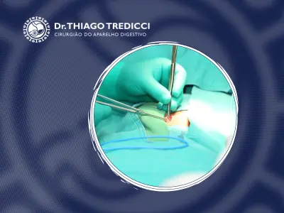 Soluções cirúrgicas para a recorrência da hérnia inguinal após procedimento cirúrgico