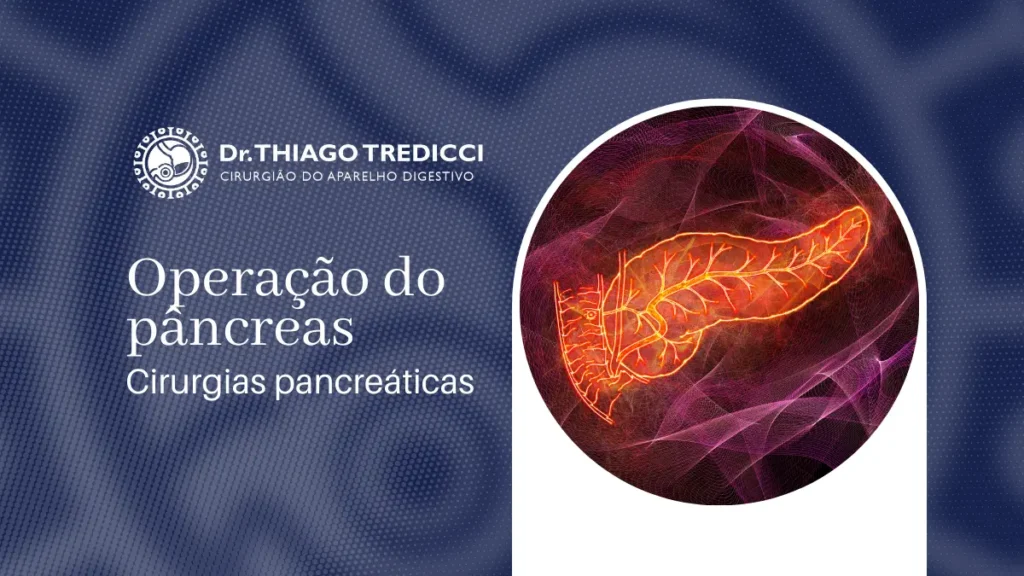 Operacao do pancreas Cirurgias pancreaticas e indicacoes para o tratamento de doencas pancreaticas