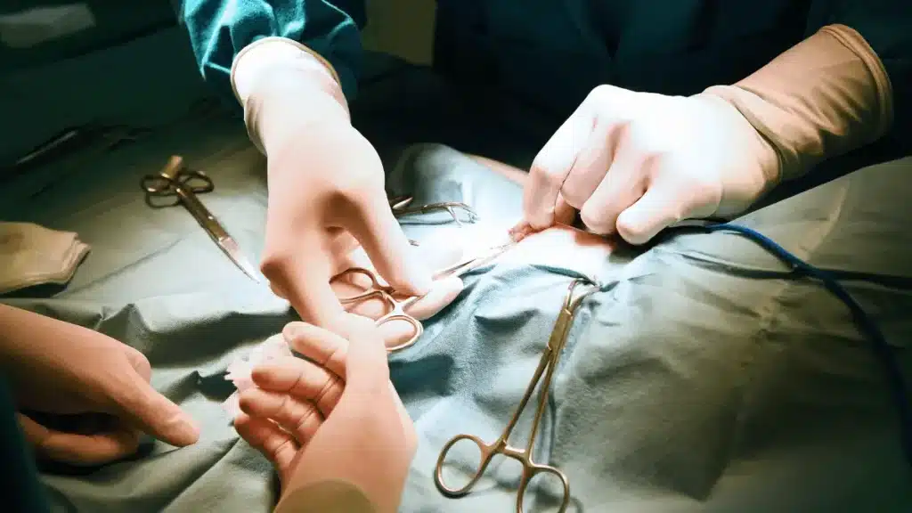 Duração da Cirurgia do Pâncreas