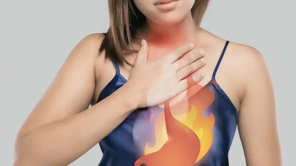 Refluxo pode matar